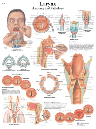 Fabrication Enterprises - From: 12-4612L To: 12-4614S - Anatomical Chart larynx, laminated