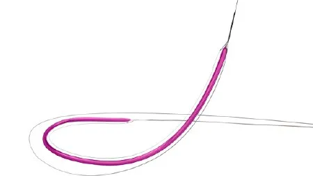 Bard - Vaccess - VA8094 - Pta Dilatation Catheter Vaccess 9 Mm Diameter X 4 Cm Length Balloon 80 Cm