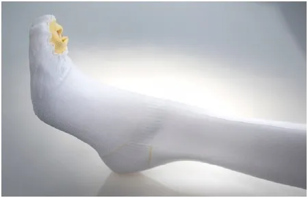 Alba Healthcare - Ultracare - 853-03 - Anti-embolism Stocking Ultracare Knee High Large / Regular Open Toe