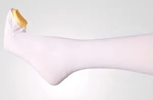 Albahealth - Lifespan - From: 573-01 To: 573-05 - Thigh Length Anti Embolism Stocking, Long, Upper Thigh Circumference Less Than Calf Circumference More Than Length Glu Furrow to Bottom of Heel More Than Top Toe