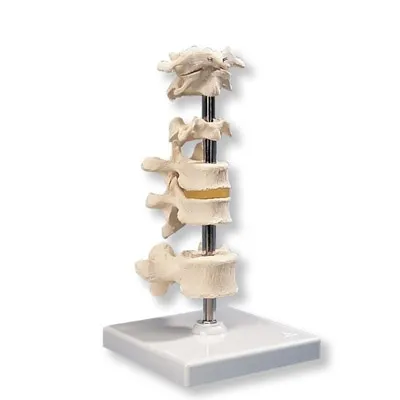 American 3B Scientific - From: A75 To: A75/1 - 6 Mounted Vertebrae